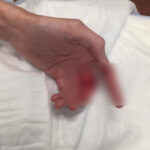 Warbeast's Guitarist Nearly Severed His Finger In A Blender Accident
