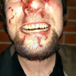 Police Actively Investigating Fan's Alleged Assault At The Hands Of Glenn Danzig & Security