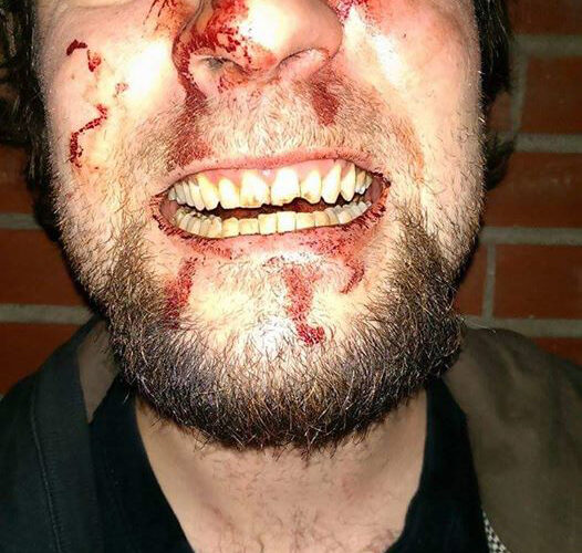 Police Actively Investigating Fan's Alleged Assault At The Hands Of Glenn Danzig & Security