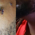 Two Women Arrested For Vicious Assault On Skindred Singer Benji Webbe
