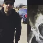 Watch The Ghost Inside's Zach Johnson Take His First Steps Since Losing Two Toes In Bus Crash