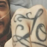 Ex-Of Mice & Men Frontman Austin Carlile Hospitalized For Spinal Fluid Leak