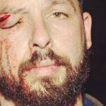 The Dillinger Escape Plan's Ben Weinman Discusses The Injuries He's Received Playing Shows
