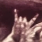 Here's The Most Metal Ultrasound Picture Ever