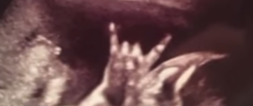 Here's The Most Metal Ultrasound Picture Ever