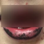 Gofundme & Benefit Shirt Launched For Woman Who Lost Four Teeth At 2017 'Sound And Fury' Fest
