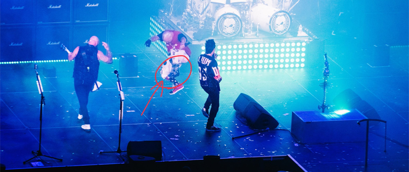 Five Finger Death Punch's Ivan Moody Appears To Have Broken His Foot