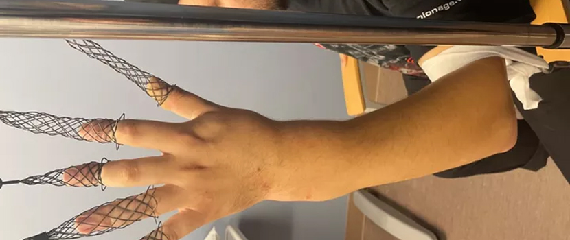 Vein.fm Drummer Matt Wood Requires Immediate Surgery For Broken Wrist, GoFundMe Launched