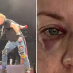 Woman Claims She Suffered Two Black Eyes After Being Struck By Mic Axl Rose Tossed Into The Audience At Adelaide Guns N' Roses Show, Axl Responds (Updated)