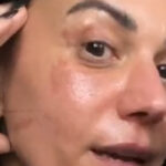 Lacuna Coil's Cristina Scabbia Recovering From Facial Burns After Cooking Accident