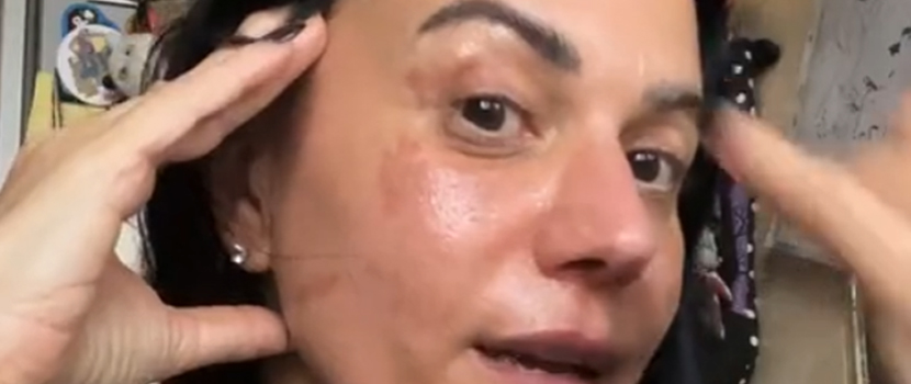 Lacuna Coil's Cristina Scabbia Recovering From Facial Burns After Cooking Accident