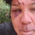 Crazy Town's Bobby Reeves Says He And Shifty Shellshock, "Got In A Little Scuffle, But It's All Good."