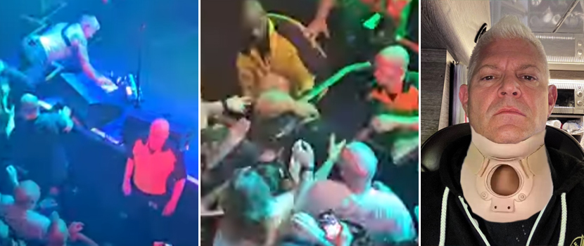 Biohazard's Billy Graziadei Endured Some Rough Falls At Last Night's Show In London