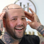 The Ghost Inside's Zach Johnson Begins Documenting His Hair Restoration Journey
