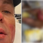 Slipknot's Sid Wilson Shows Off The Extent Of His Burns In New Video: "My Face Is Basically Melted From Nose Down"