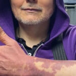 The Smashing Pumpkins' Billy Corgan Speaks On Learning To Embrace His Birthmarks