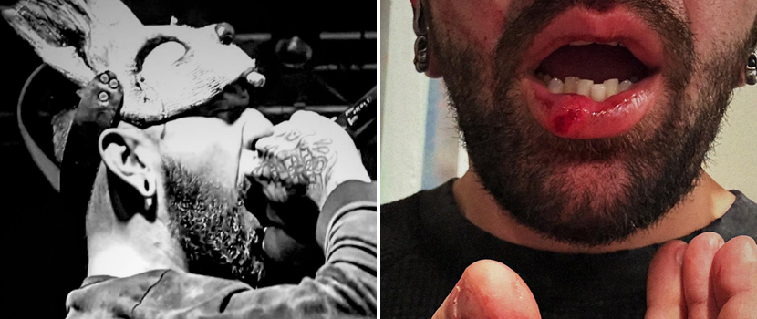 The Bunny The Bear Stop Chicago Show After Audio Engineer Allegedly Assaulted Singer's Wife & A Promoter