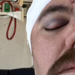 GoFundMe Launched For Man Left With Serious Head Injury Following Stage Dive Accident