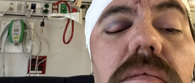 GoFundMe Launched For Man Left With Serious Head Injury Following Stage Dive Accident
