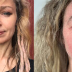 Karyn Crisis Launches GoFundMe After Being "Disabled And Disfigured" By A Medically Prescribed Treatment