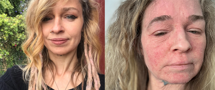 Karyn Crisis Launches GoFundMe After Being "Disabled And Disfigured" By A Medically Prescribed Treatment