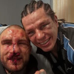 Slaughter To Prevail's Alex Terrible Shares Photo Following His Latest Bare Knuckle Fighting PPV Bout