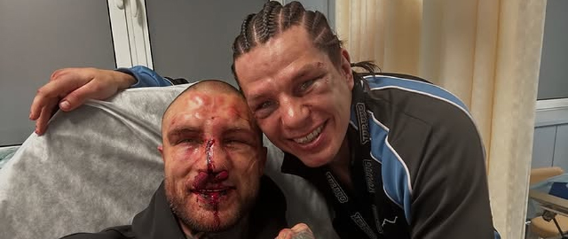 Slaughter To Prevail's Alex Terrible Shares Photo Following His Latest Bare Knuckle Fighting PPV Bout