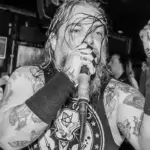 Crowdfunding Underway For Ringworm's Human Furnace Following Recent Surgery