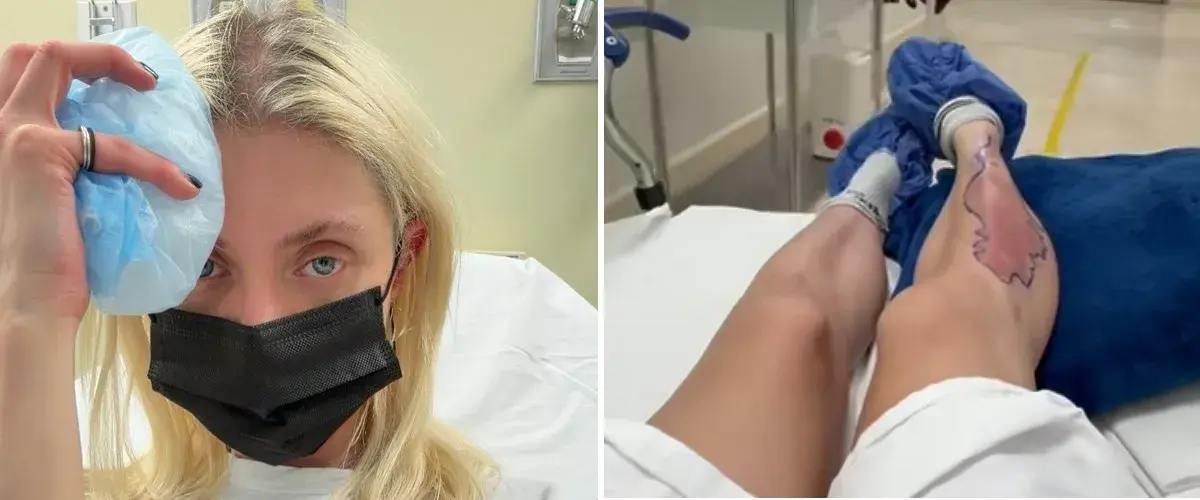 The Pretty Reckless' Taylor Momsen's Recent Spider Bite Saw Her Spend Last Night In The Hospital