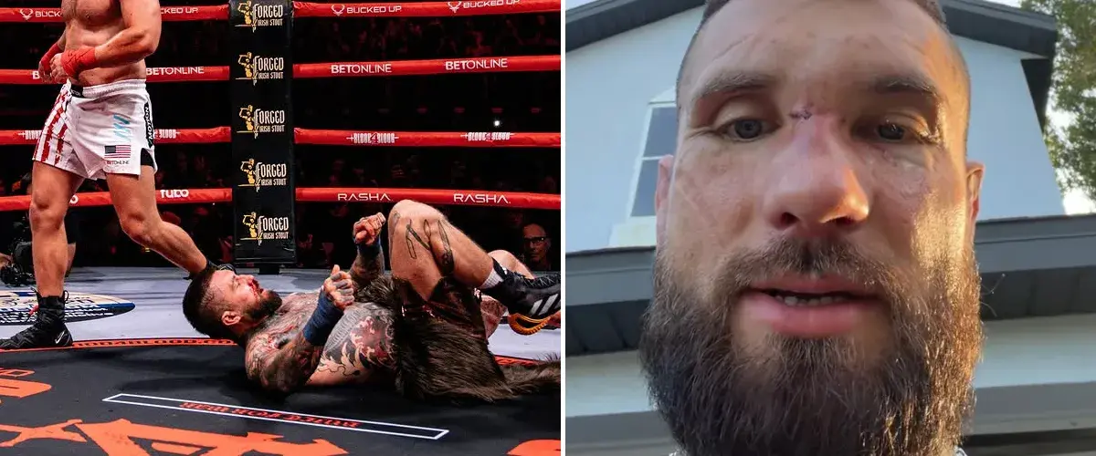 Alex Terrible Comments On His Loss At His First-Ever 'Blood4BLood' Metal & Bare Knuckle Fighting Event: "My Ass Got Whooped"