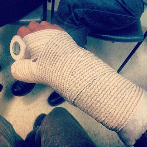 Ben Weinman's Broken Hand