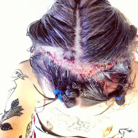 Continents' Tom Weaver