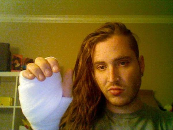 Michael Keene's Injury