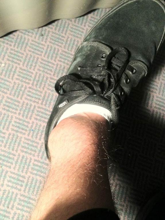 Nick Xourafas' Injured Ankle