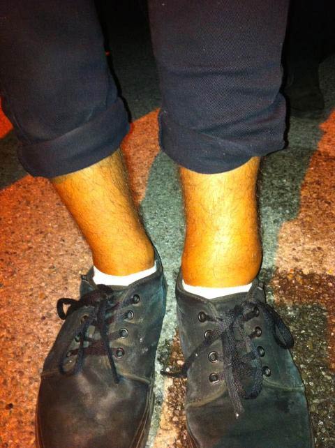 Nick Xourafas' Injured Ankle