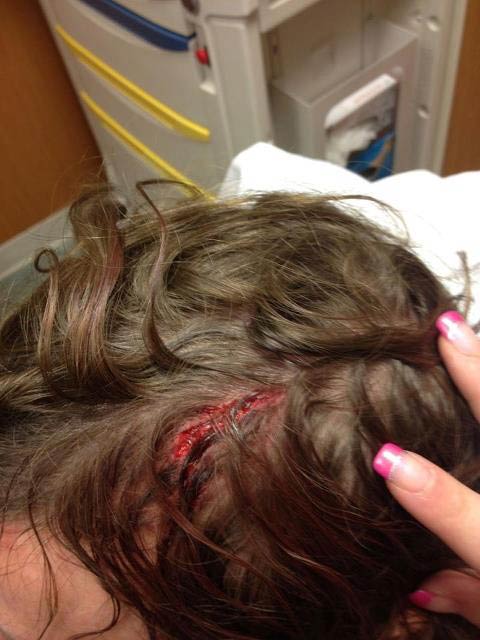 Mikael Åkerfeldt's Head Injury