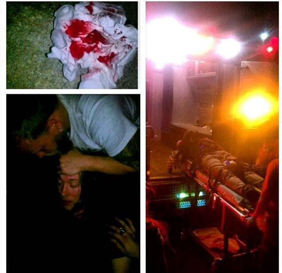 Surrounded By Monsters Singer Injured